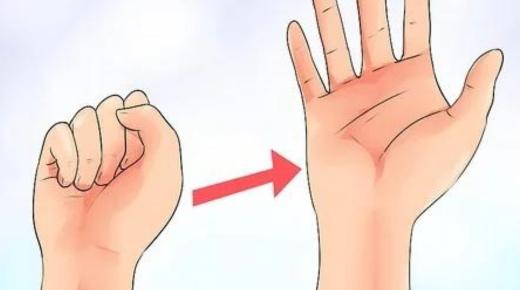 After Carpal Tunnel Surgery Exercises - A Guide to Rehabilitation