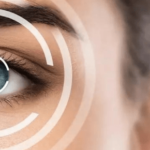 Will Medicaid Cover LASIK Eye Surgery –  Understanding Your Options