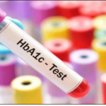 All About the HBA1C Blood Test: A Comprehensive Guide to Managing Diabetes