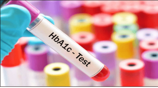 All About the HBA1C Blood Test: A Comprehensive Guide to Managing Diabetes