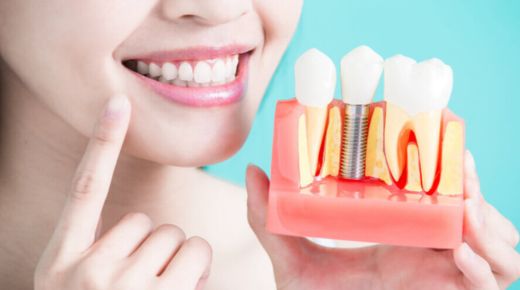 Dental Implants for People with Metal Allergies