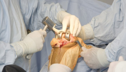 Orthopaedic Hospital in Bangalore, Best Orthopaedic Hospital in Bangalore