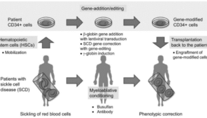 BEAM’s Risto-Cel Shows Durable Profile in Sickle Cell Trial
